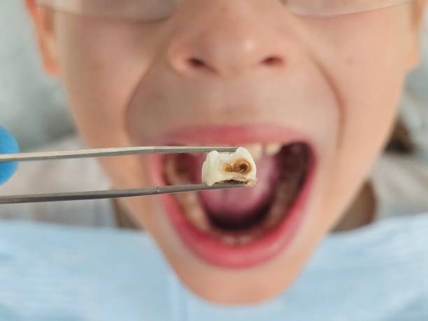 Best Emergency Denture Repair in Clearfield, PA
